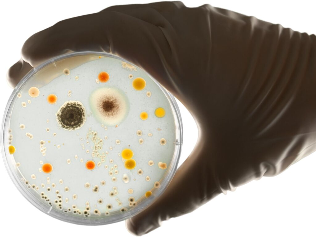 Microflora on a petri dish